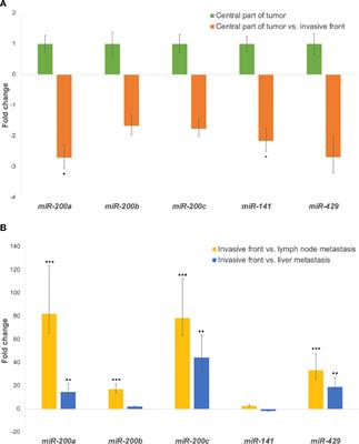 Epithelial-Mesenchymal Transition in Colorectal Carcinoma: Comparison Between Primary Tumor, Lymph Node and Liver Metastases